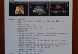談醫(yī)用彩超膠片的運(yùn)用室內(nèi)環(huán)境有什么