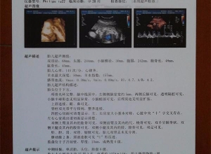 談醫(yī)用彩超膠片的運(yùn)用室內(nèi)環(huán)境有什么